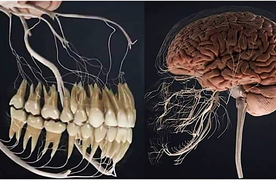 12 изображений, которые расскажут о нашем теле лучше любого учебника 12 изображений, которые расскажут о нашем теле лучше любого учебника